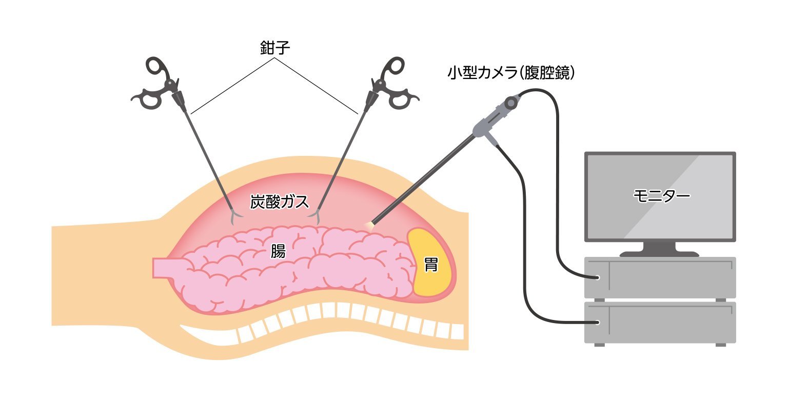 手術の流れと費用相場、安全性を高めるポイント