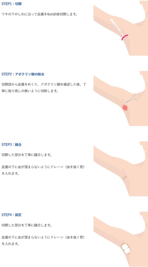 術後1週間の生活ケアと環境づくり