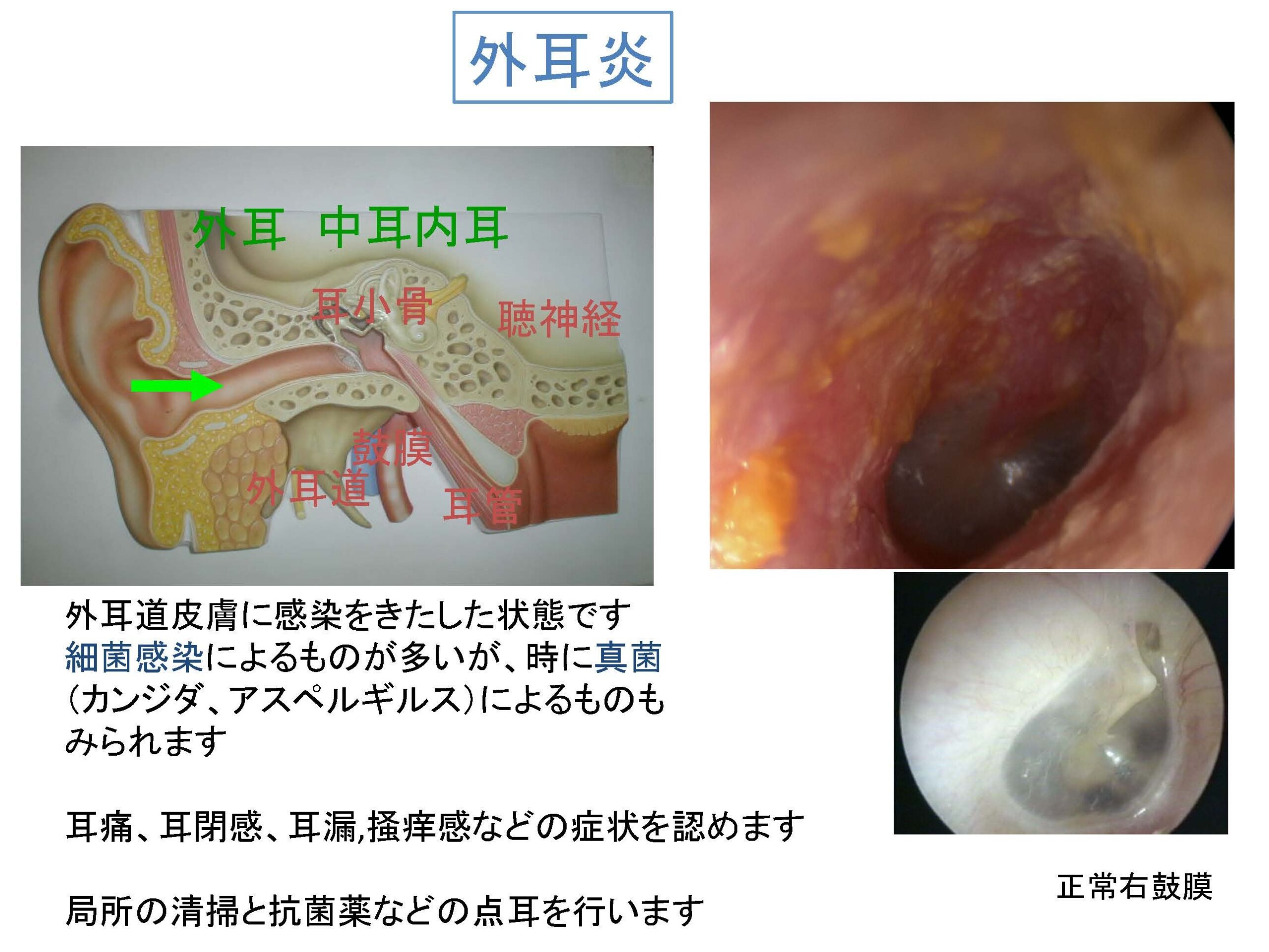 耳の臭い・病気を予防する生活習慣