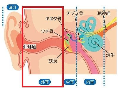 外耳炎の治療費と市販薬・予防ケアの費用感