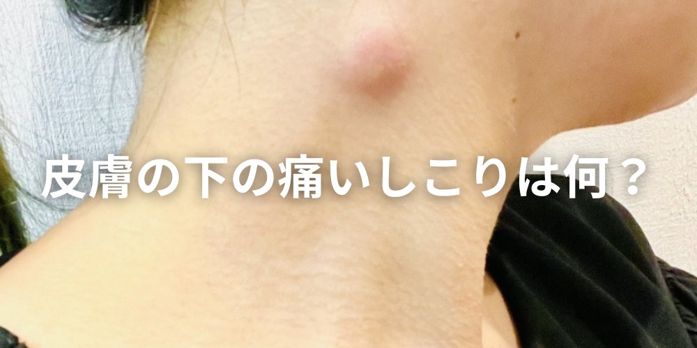 危険なアレルギー症状と受診の目安