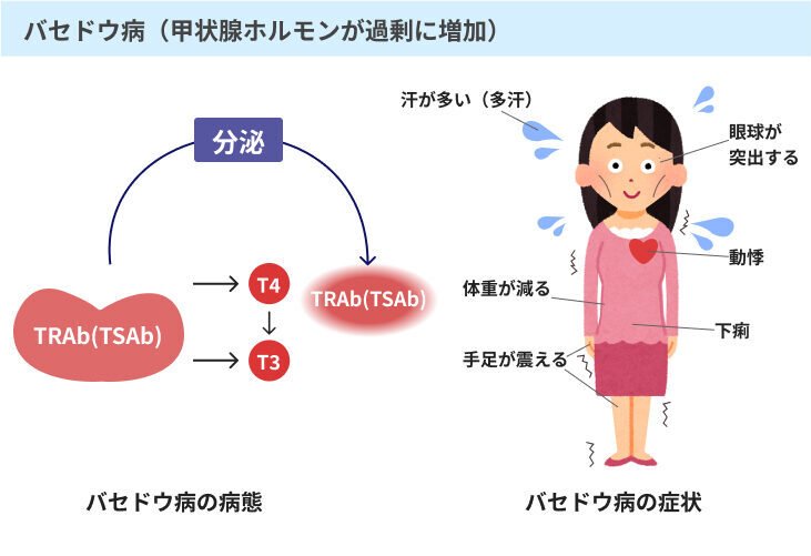症状を抑えるための医師による主な治療方法