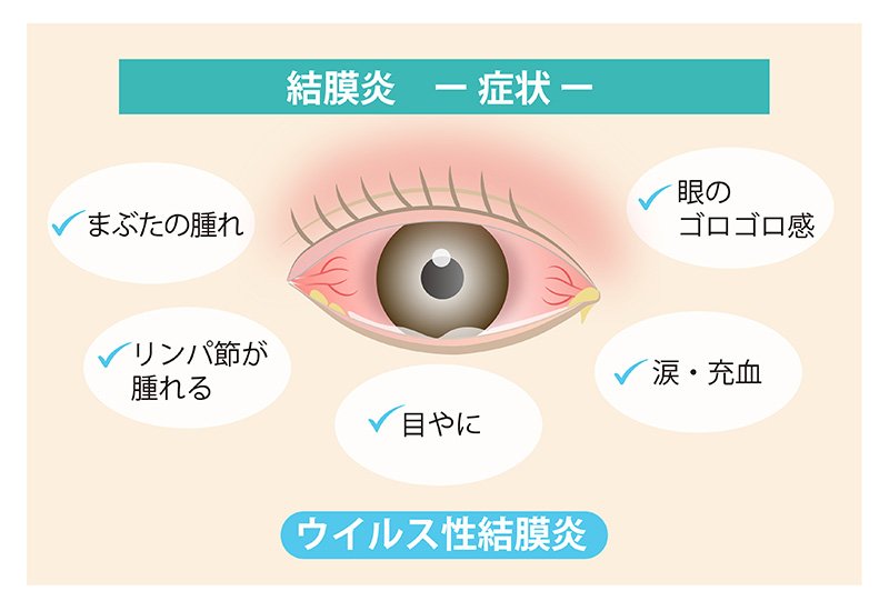 目やにの記録のつけ方と獣医師への伝え方