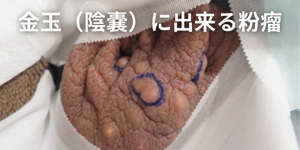 自宅でできる陰嚢まわりのケアと観察のコツ