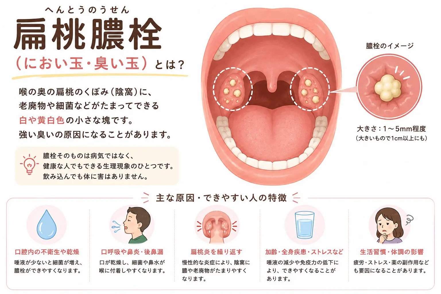 「玉が戻ってきた？」と感じる代表的な原因
